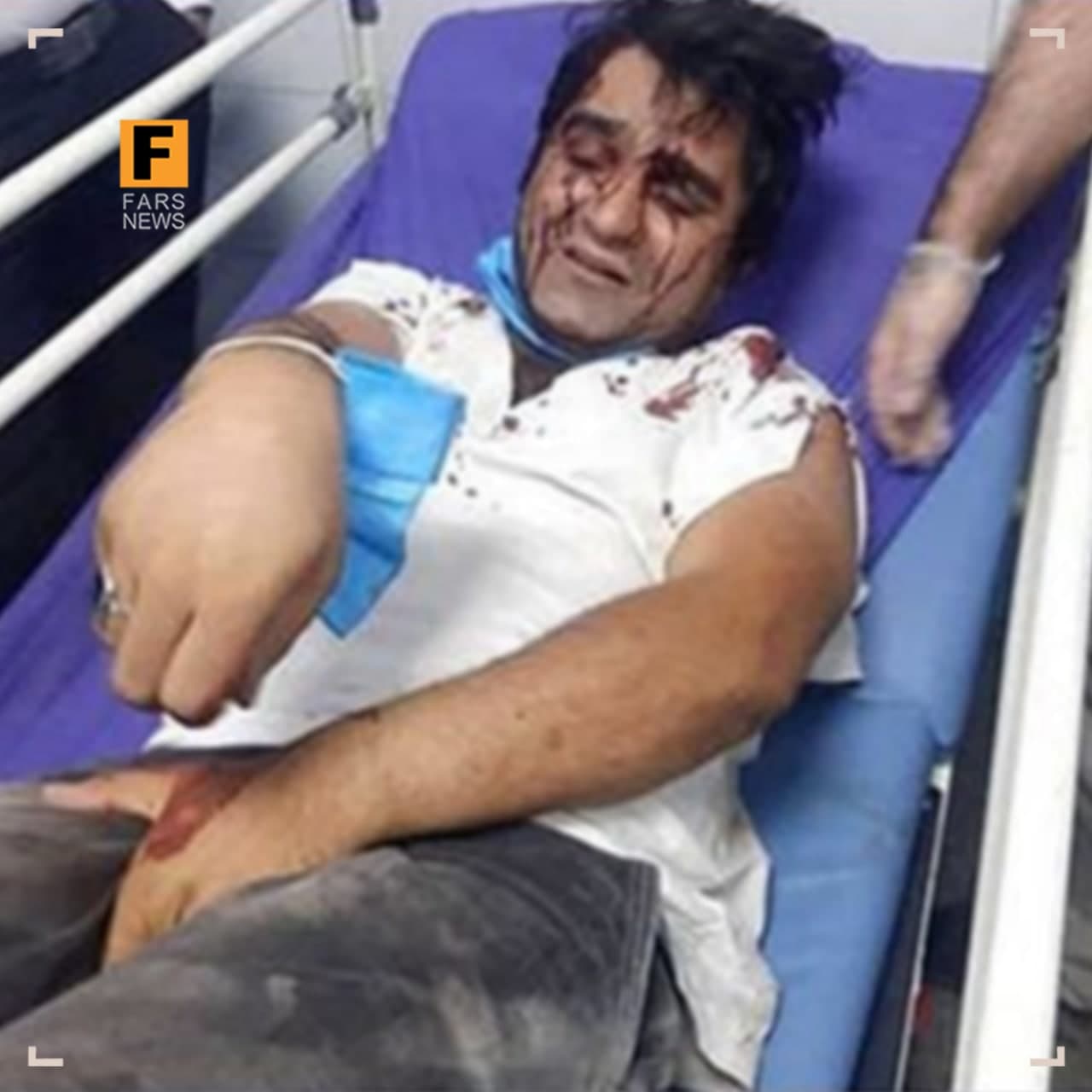 بازیگر دودکش