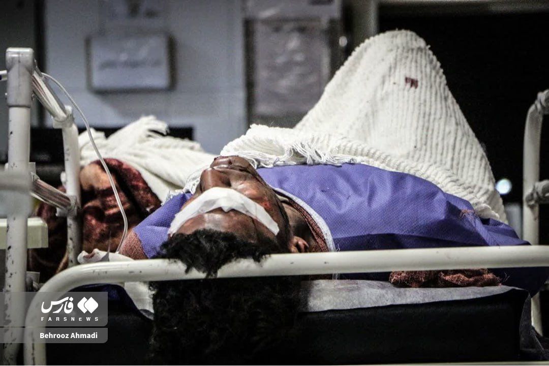تصاویر دلخراش مصدومان چهارشنبه‌سوری