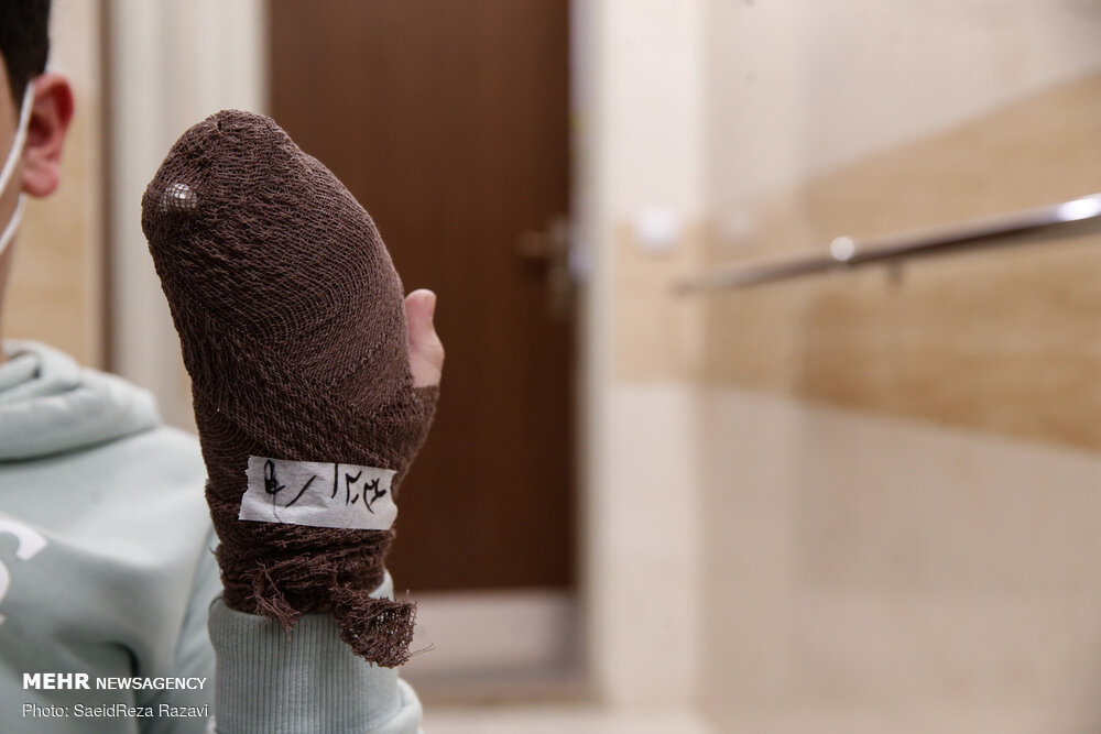 تصاویر دلخراش از مصدومان چهارشنبه آخر سال