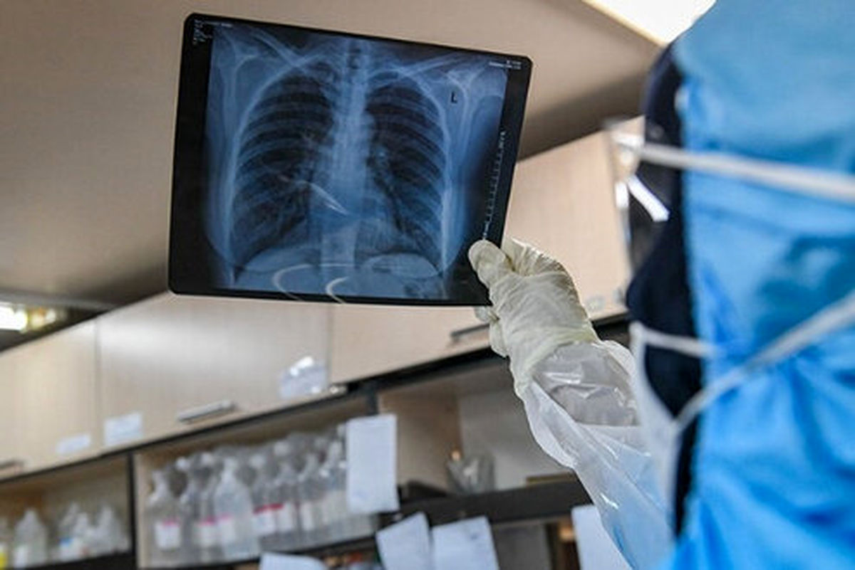 سازمان جهانی بهداشت: موج اول شیوع کرونا پایان نگرفته است