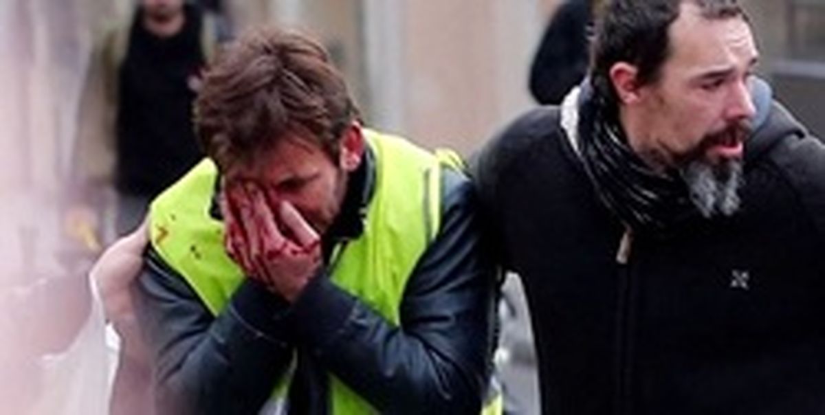 از دست دادن چشم بهای اعتراض در فرانسه +عکس