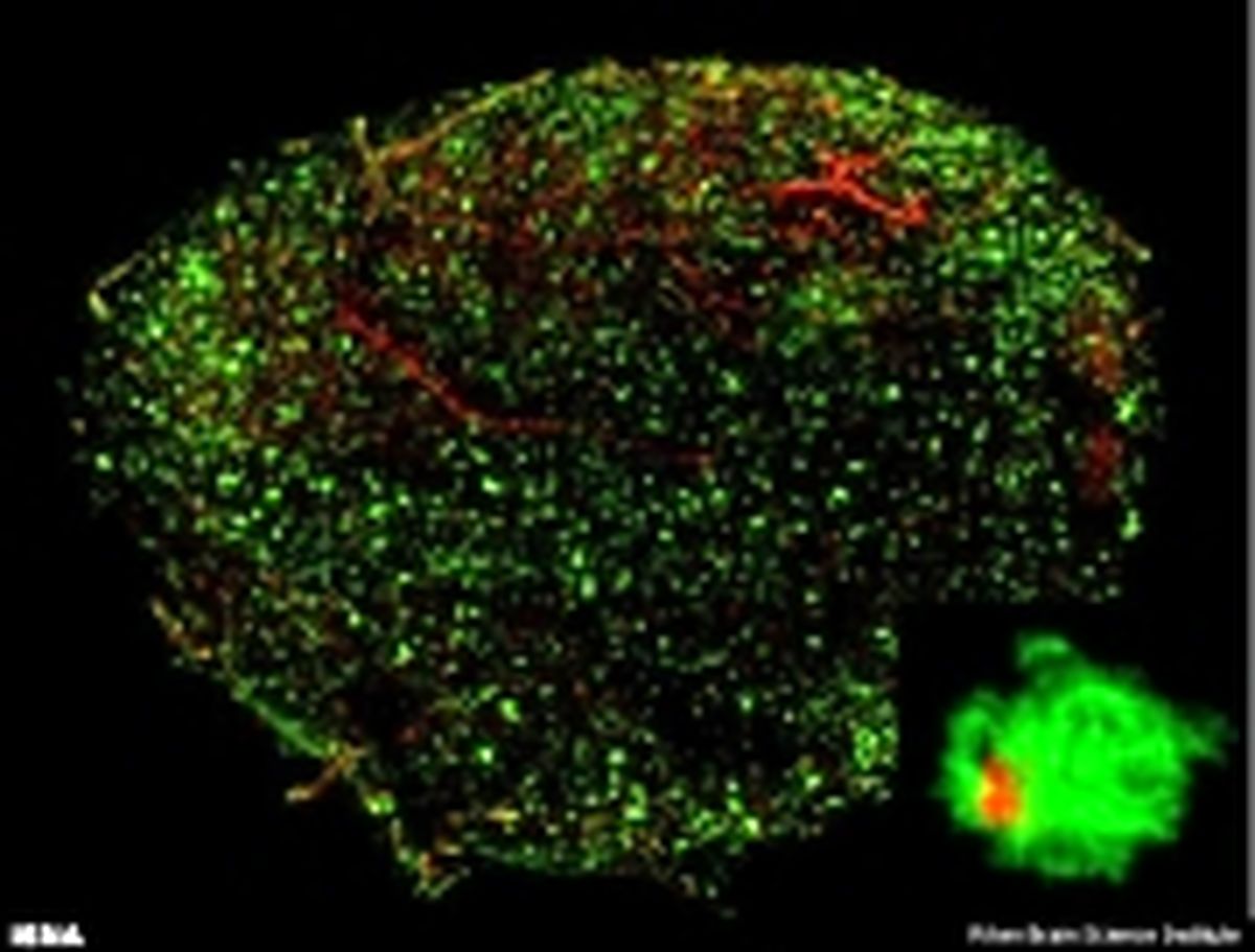 شفاف سازی مغز برای تشخیص آلزایمر!