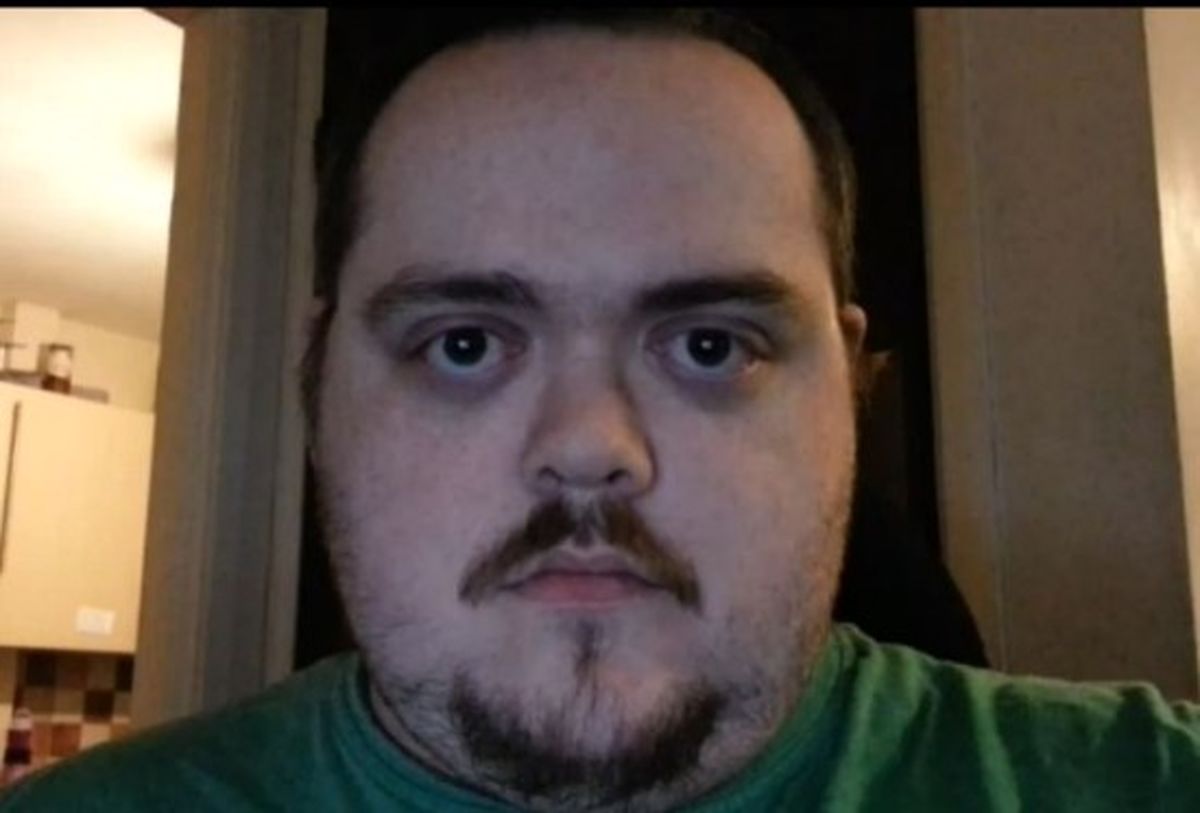 چشم های این مردازحدقه درمي آيد/تصاویر