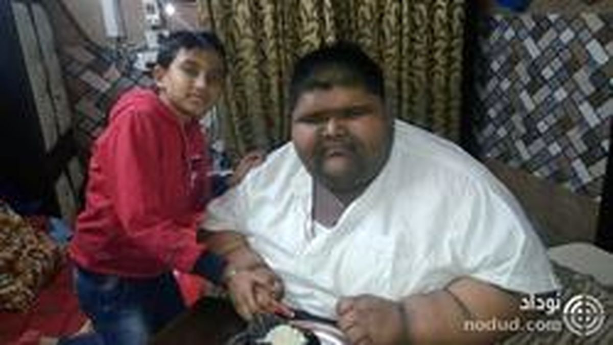 کاهش وزن چشمگیر سنگینترین نوجوان جهان! + عکس