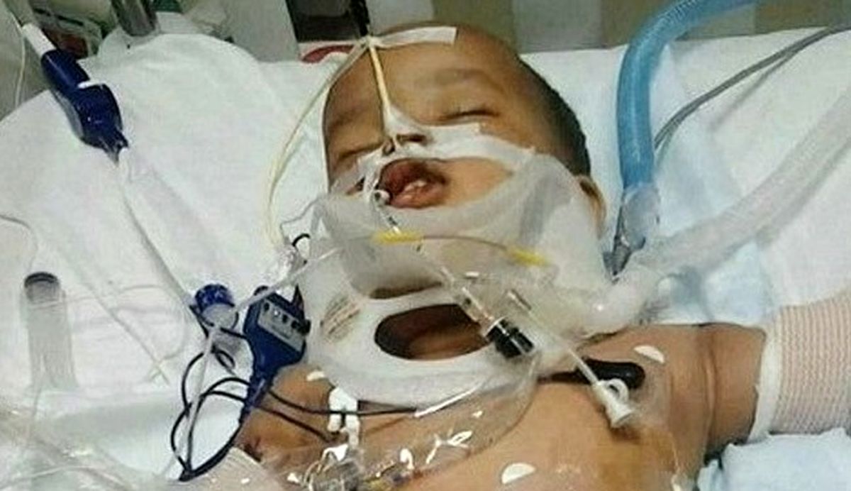 نجات‌کودکی‌که‌ازطبقه‌یازدهم‌سقوط‌کرد/عکس