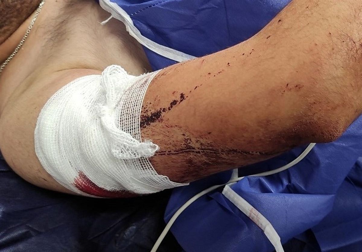 یک دانشجوی دیگر قربانی زورگیری شد؛ این بار در استان گلستان!