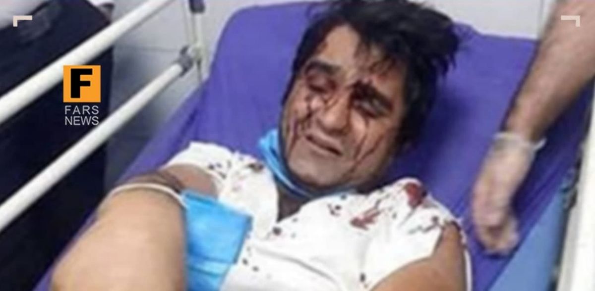 ضرب و شتم بازیگر «دودکش» به جرم حمایت از رئیسی! +عکس