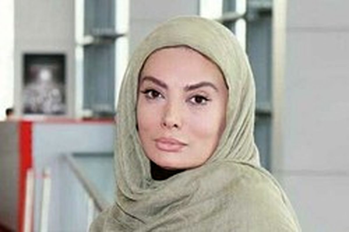 ماجرای جراحی زیبایی خانم بازیگر که جنجال بپا کرد