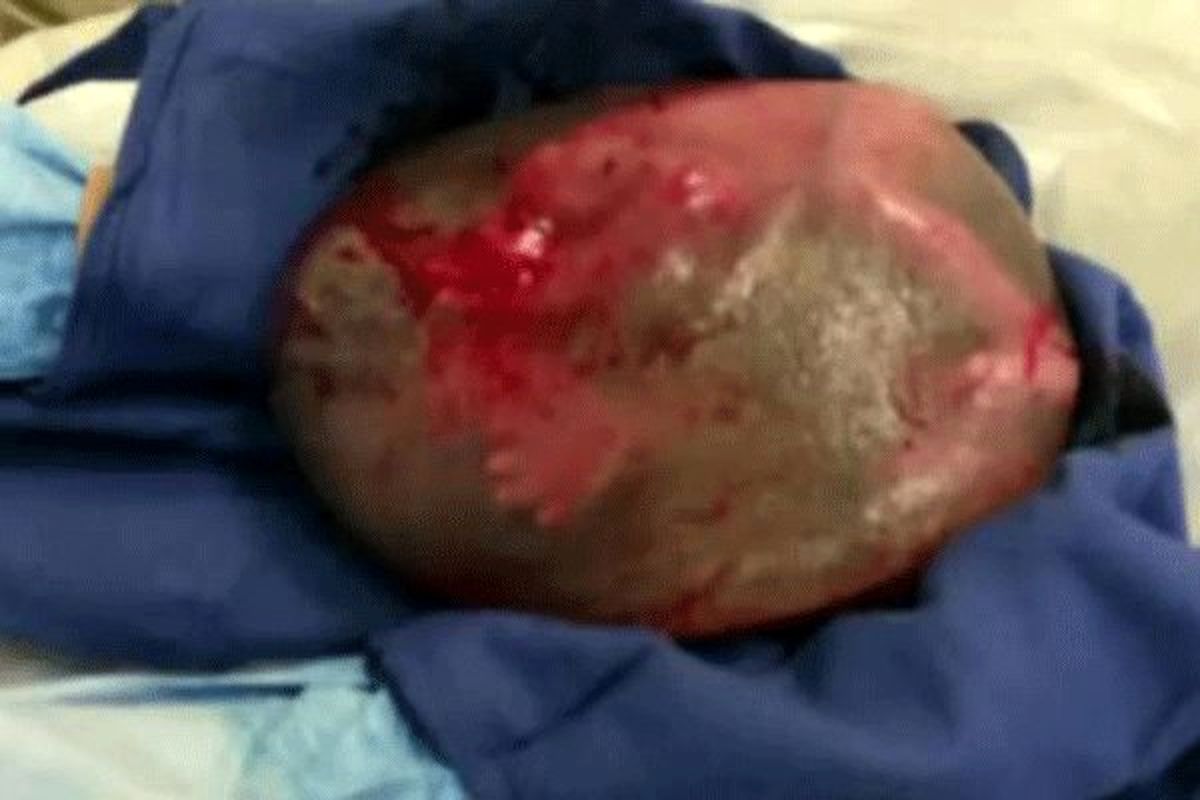 تصویری عجیب و نادر از تولد یک نوزاد