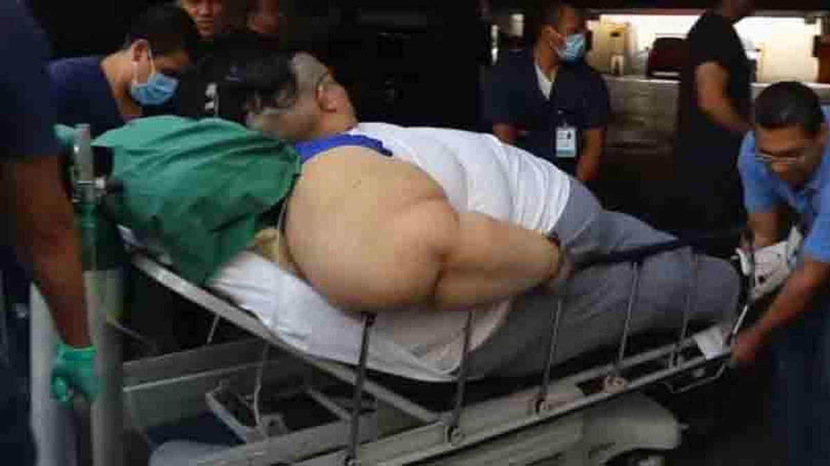 مرد ۶۰۰ کیلویی می‌خواهد نصف شود! +عکس