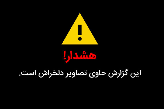 تصاویر: قربانیان اسید پاشی‎ در ایران و جهان