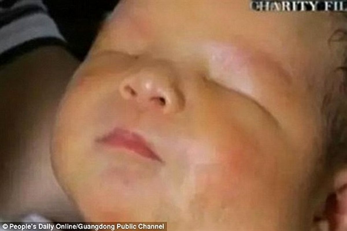 تولد نوزاد بدون چشم مادرش را شوکه کرد +تصاویر