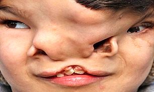کودکی که پس از7سال واردجامعه شد/عکس