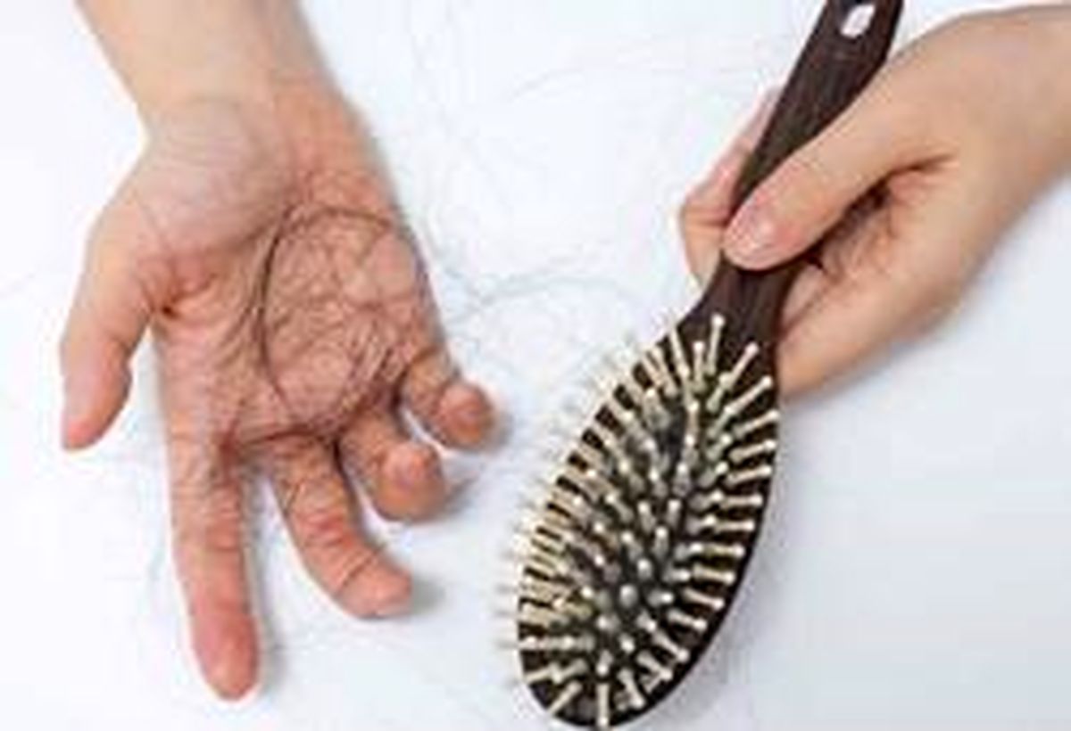 چرا کاهش وزن باعث ریزش مو میشود؟