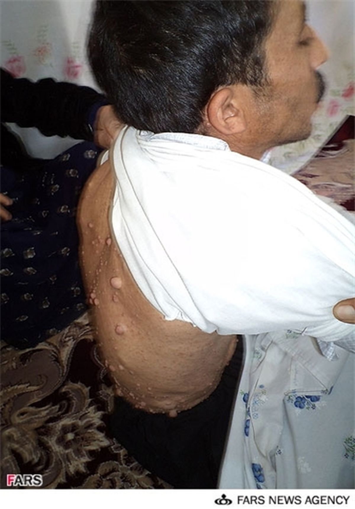 روستایی‌که‌پس‌ازقطعنامه‌شیمیایی‌شد/عکس