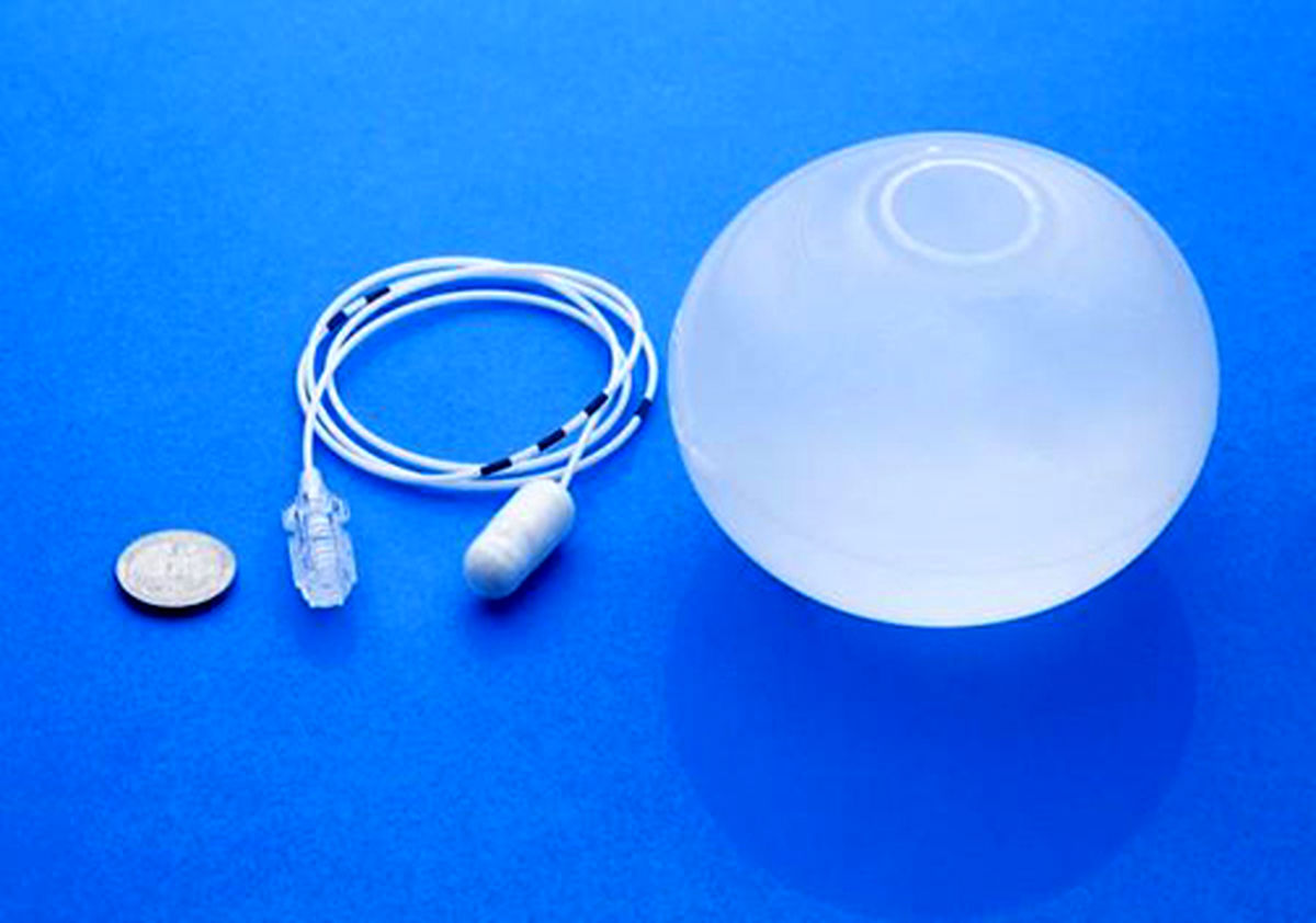 قرص‌های بالونی جایگزین بای َپسِ معده + تصاویر