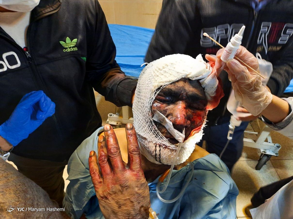 تصاویر: مصدومان چهارشنبه آخر سال ۱۳۹۹