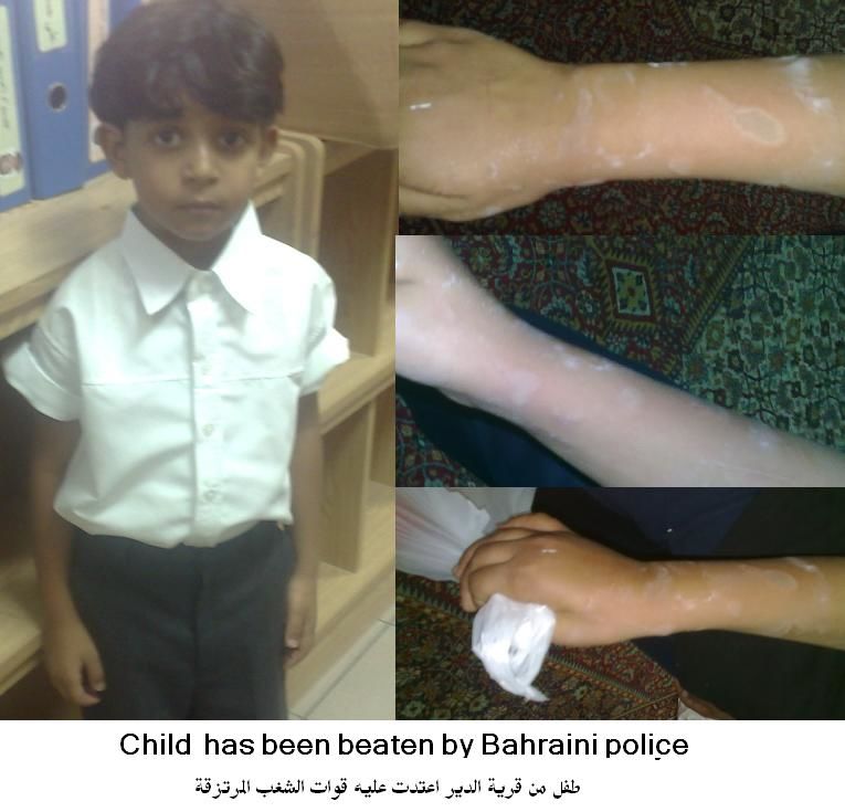 بزرگ‌ترین زندان کودکان در جهان/تصاویر