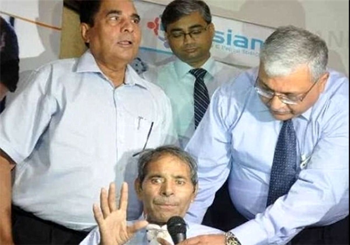 تلاش برای خارج کردن ۱۵۰ میخ از بدن مرد هندی! +تصاویر