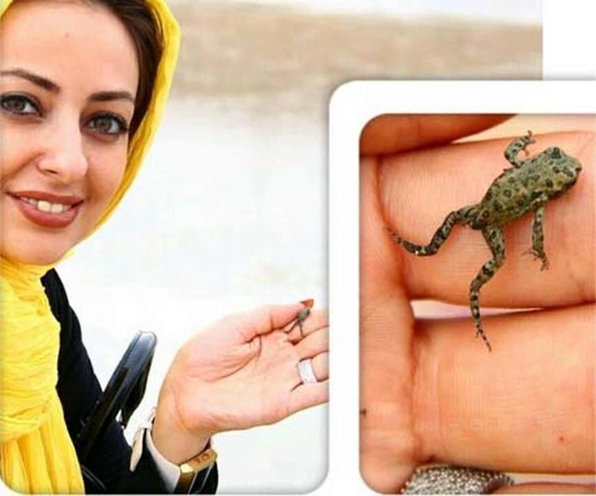 قورباغهبندانگشتیدردست بازیگر زن/عکس