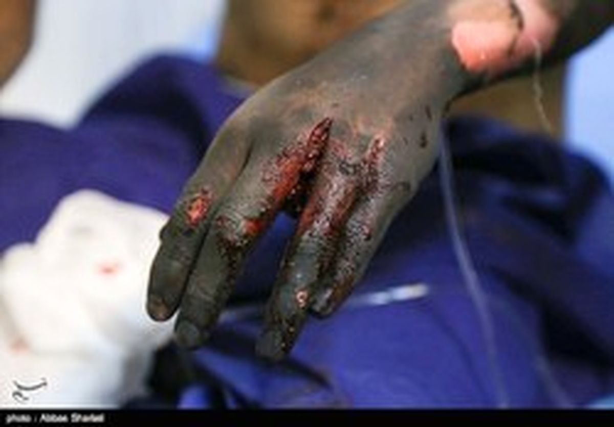 چهارشنبه سوری پیشاپیش قربانی گرفت