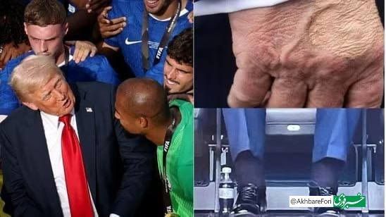 ترامپ تومور گرفت