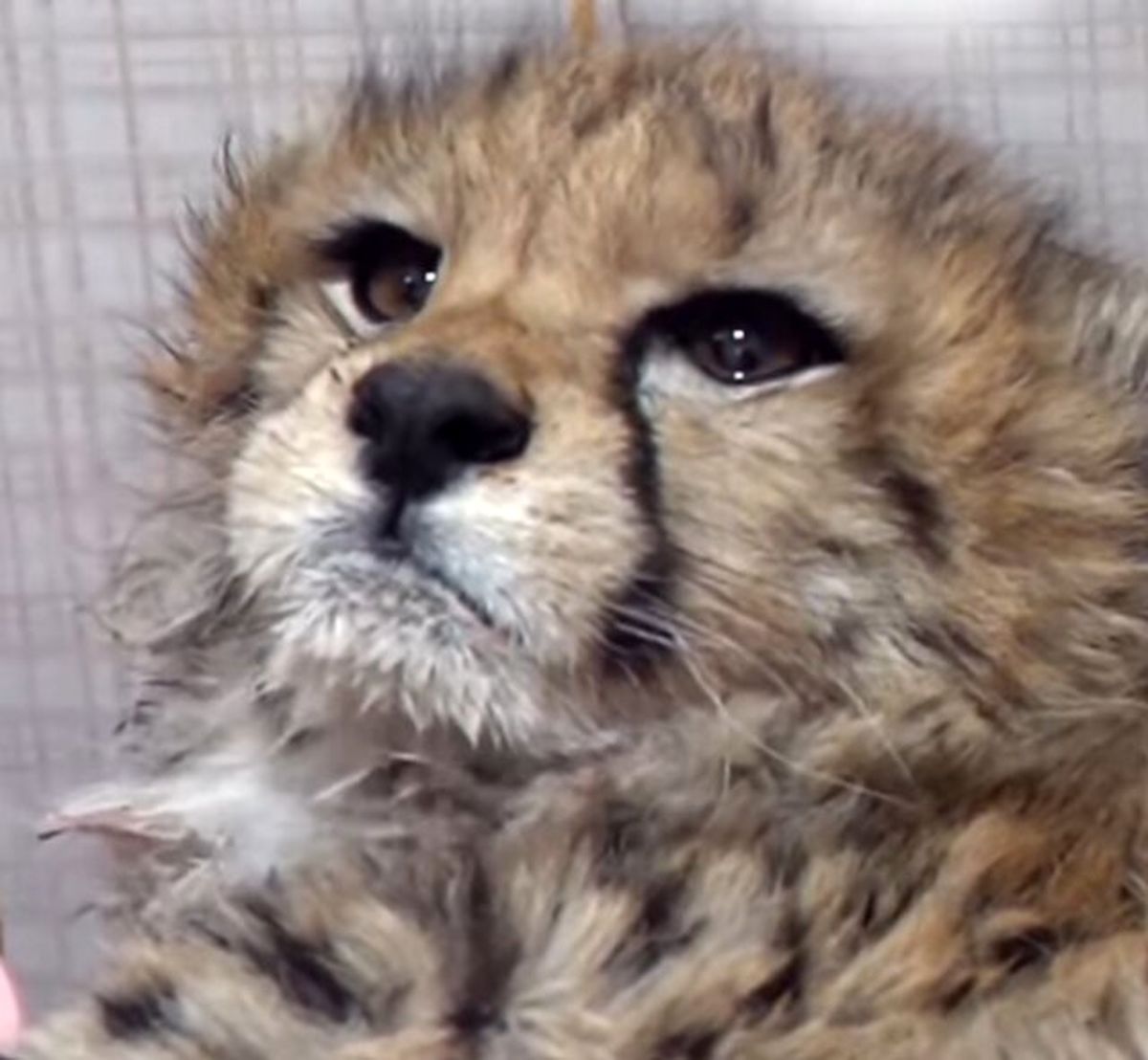 دیالیز «پیروز» آغاز شد