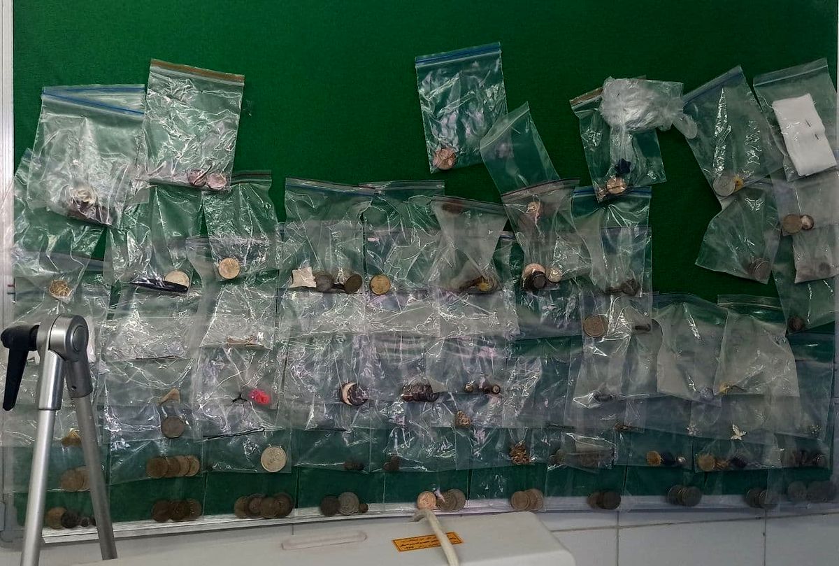 اشیا عجیب در شکم بچه‌ها +عکس