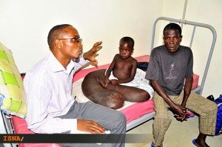 بيماری عجيب پسر اوگاندايي/تصویر