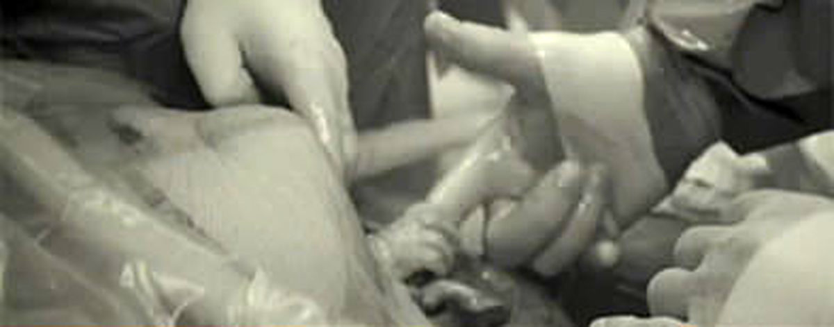 فشردن انگشت دکتر قبل از تولد+تصاویر