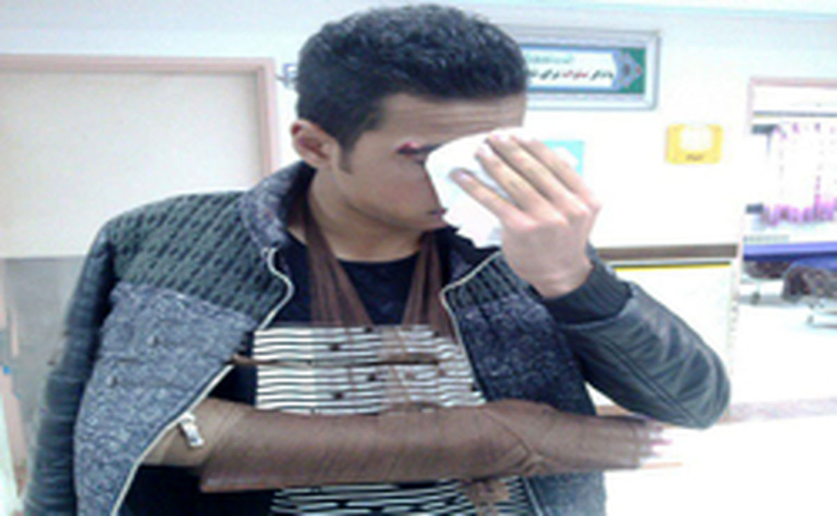 معلم عصبانی، دست دانش آموزش را شکست! +عکس