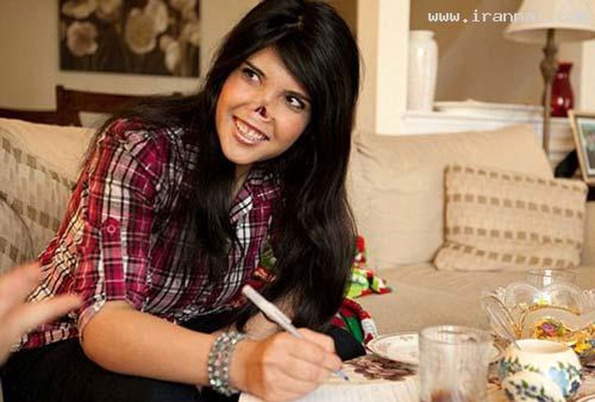 تصاویر‌/‌ترمیم‌بینی‌از‌جا‌کنده‌شده‌دختر‌جوان!