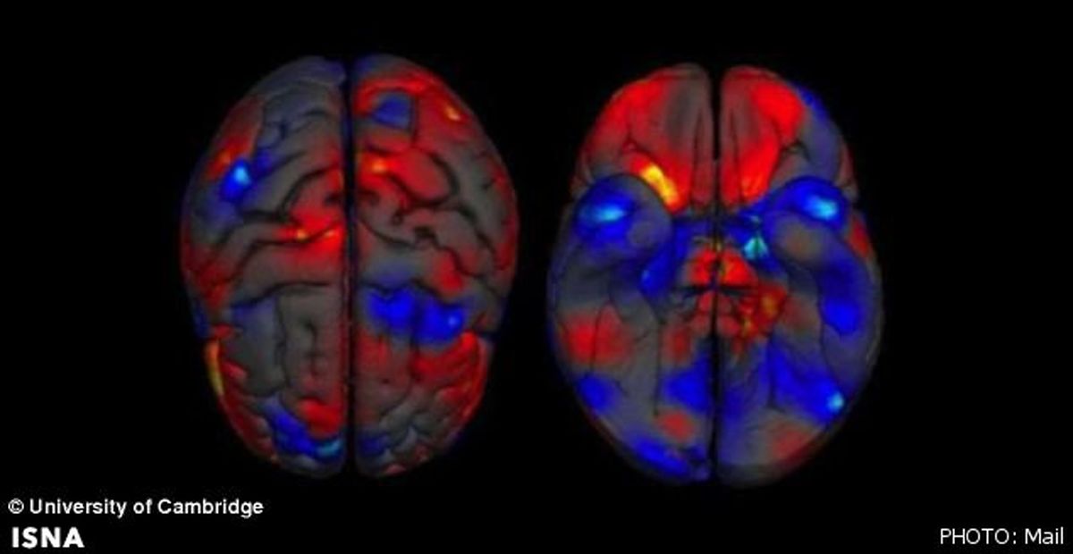 مغز مردان واقعا بزرگ‌تر است!