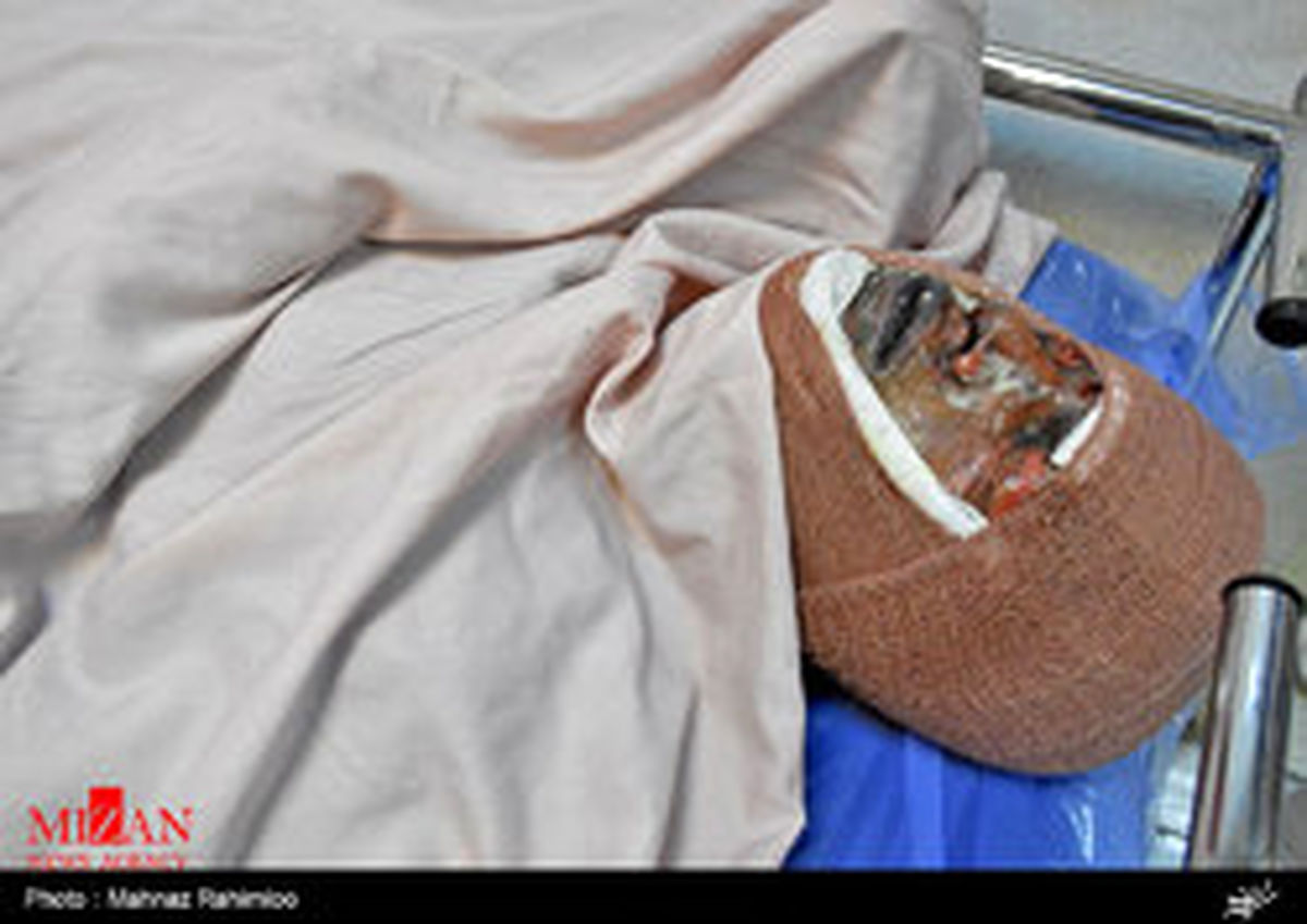 آماده باش بیمارستان سوانح سوختگی تهران