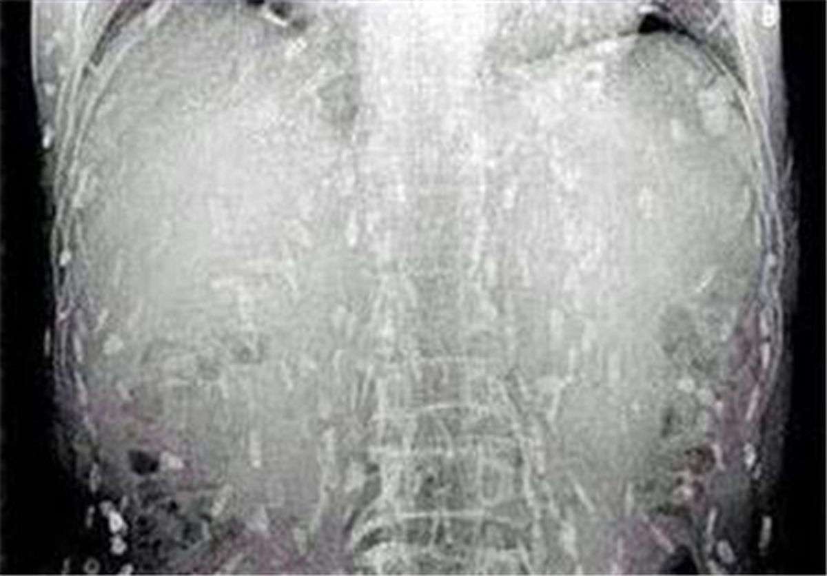 عاقبت خوردن سوشی/تصاویر