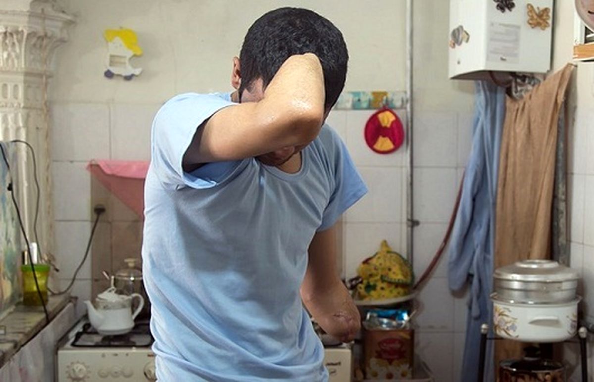 فراخوان تهیه دست مصنوعی برای دانشجویی که حین کارگری هر دو دستش قطع شد