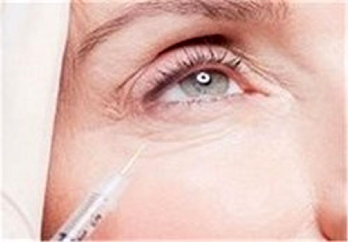 آیا تزریق بوتاکس در دوران شیردهی مجاز است؟