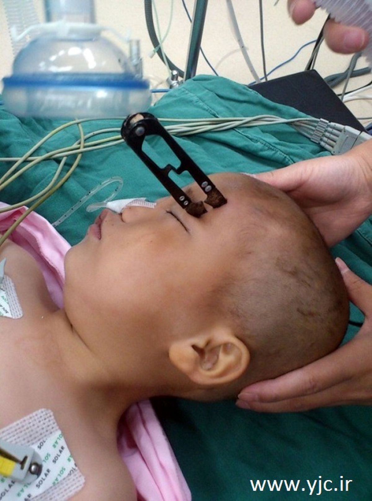 زنده ماندن معجزه وار پسر2ساله / عکس