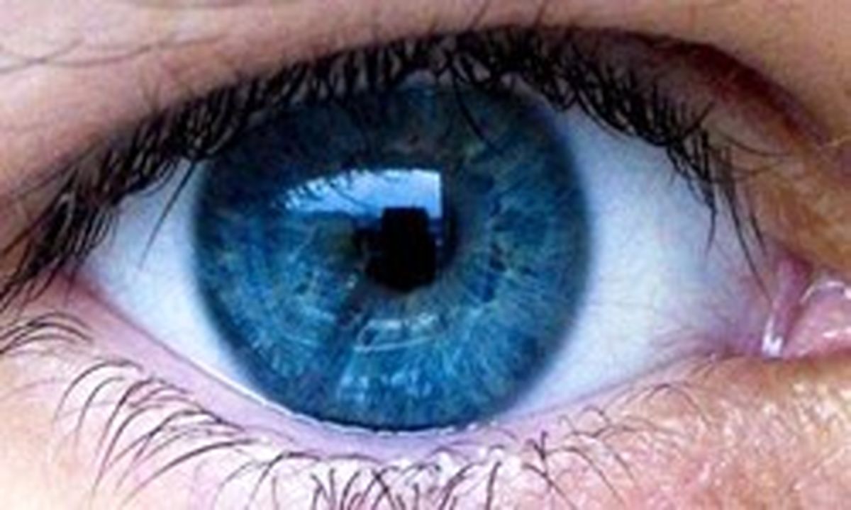راهکاری‌هایی برای از بین بردن پف زیر چشم‌ها