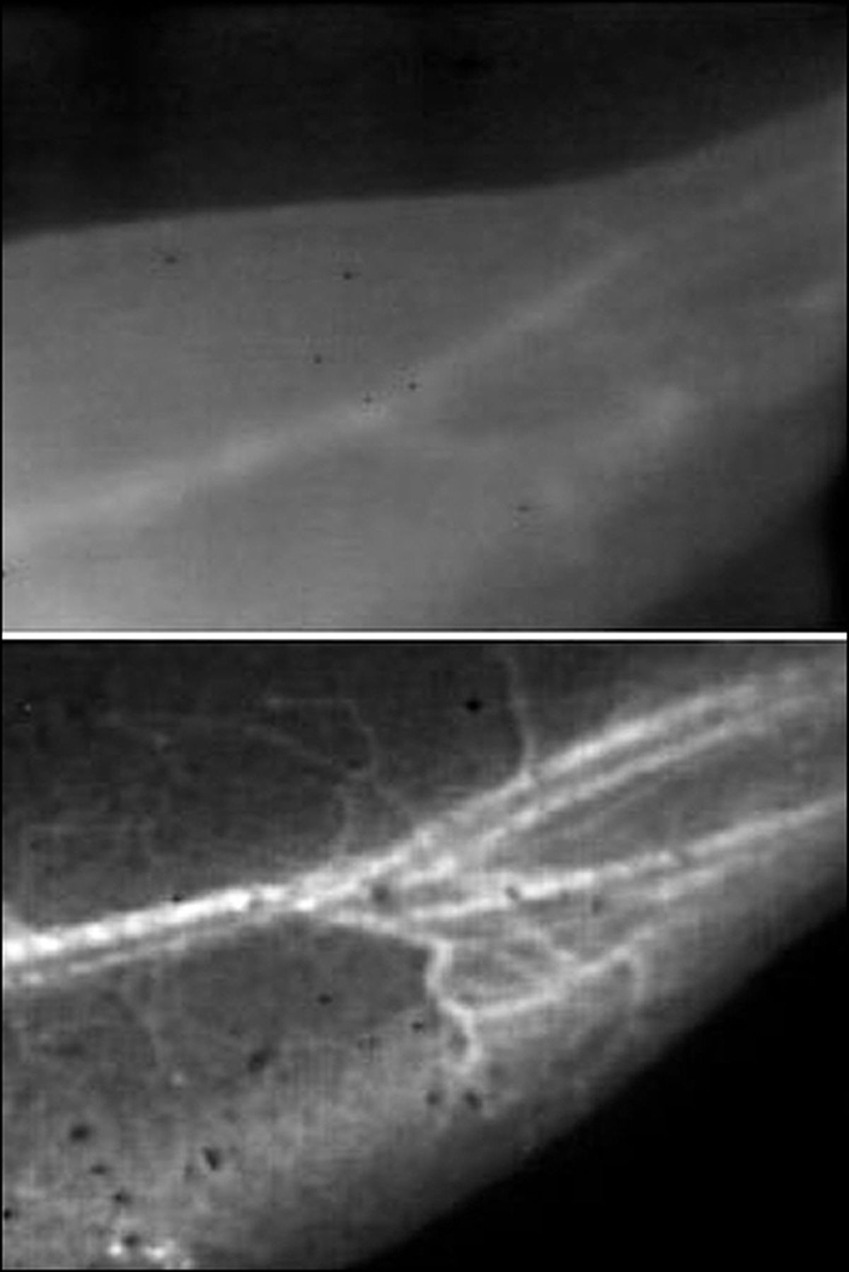 تصویری با وضوح بی‌سابقه از جریان خون