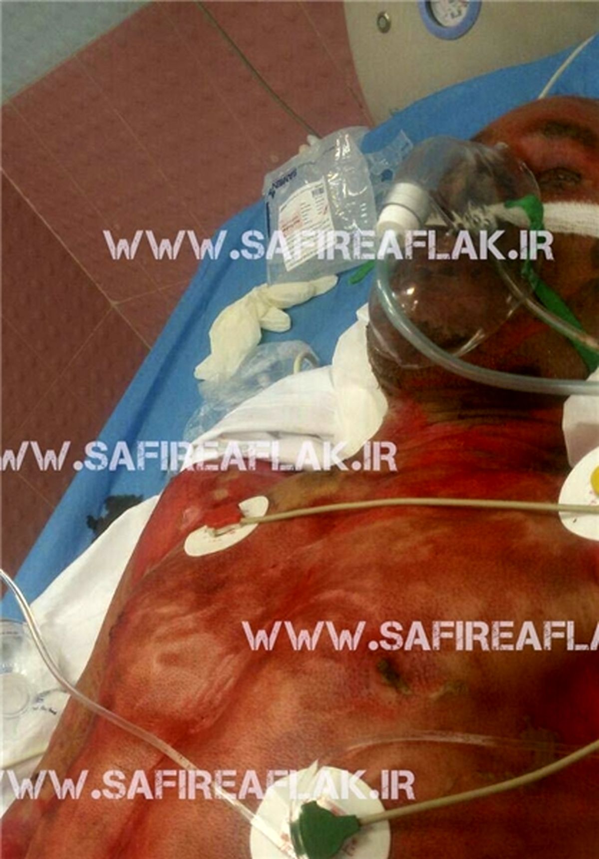 پدری خود را فدای اطفای حریق مراتع کرد +عکس