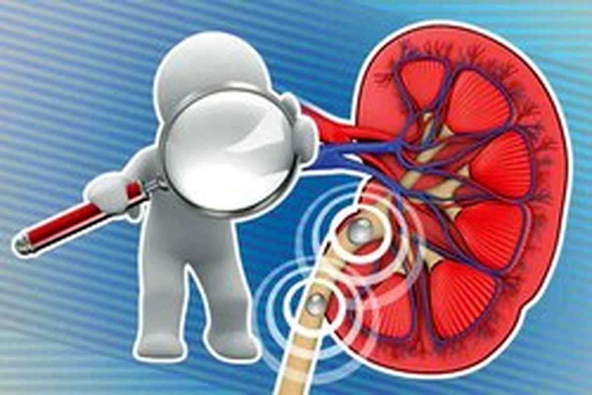 هشدار‌های تغذیه‌ای برای مبتلایان به سنگ کلیه