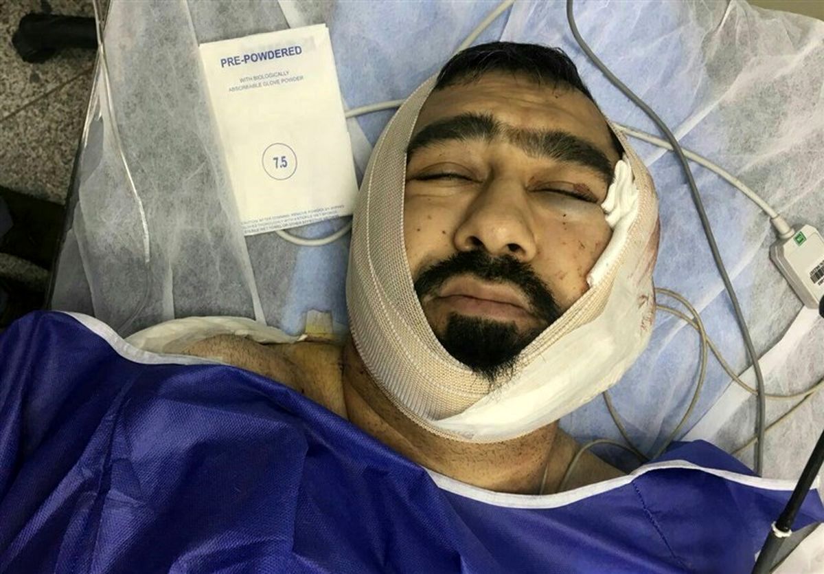 حمله فرد اوباش با قمه به یک طلبه در شرق تهران +عکس