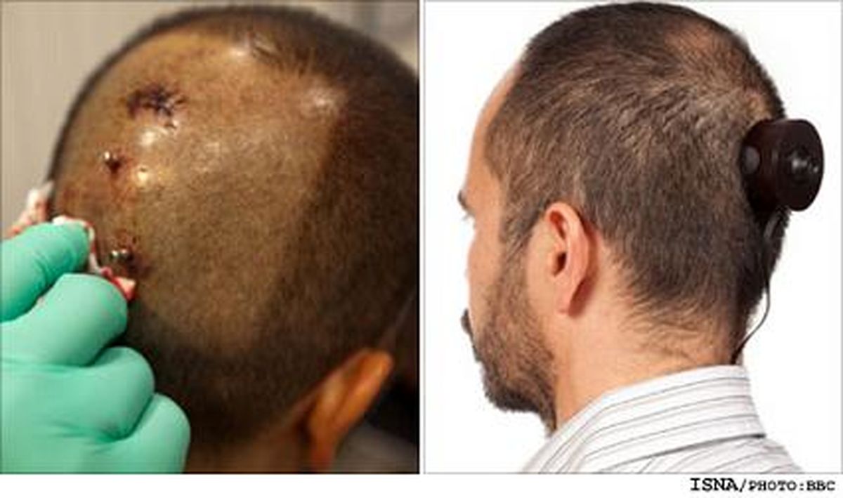 عكاسی دوربين پشت سرش كار گذاشت +عکس