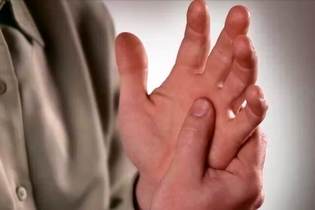 توصیه‌هایی مفید برای مبتلایان به آرتریت