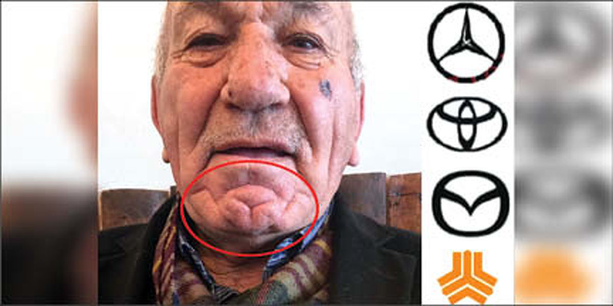 از نقش بنز تا سایپا روی چانه پیرمرد ترک! +عکس