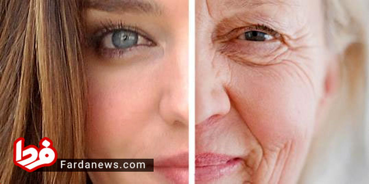 ۸ روش برای جوان ماندن بدون بوتاکس کردن