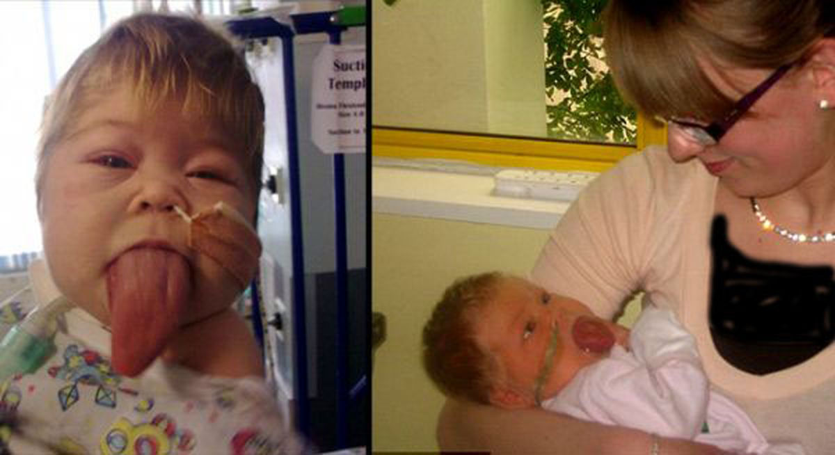 کودکی‌که‌پیوسته‌زبانش‌رشدمی‌کند!/عکس