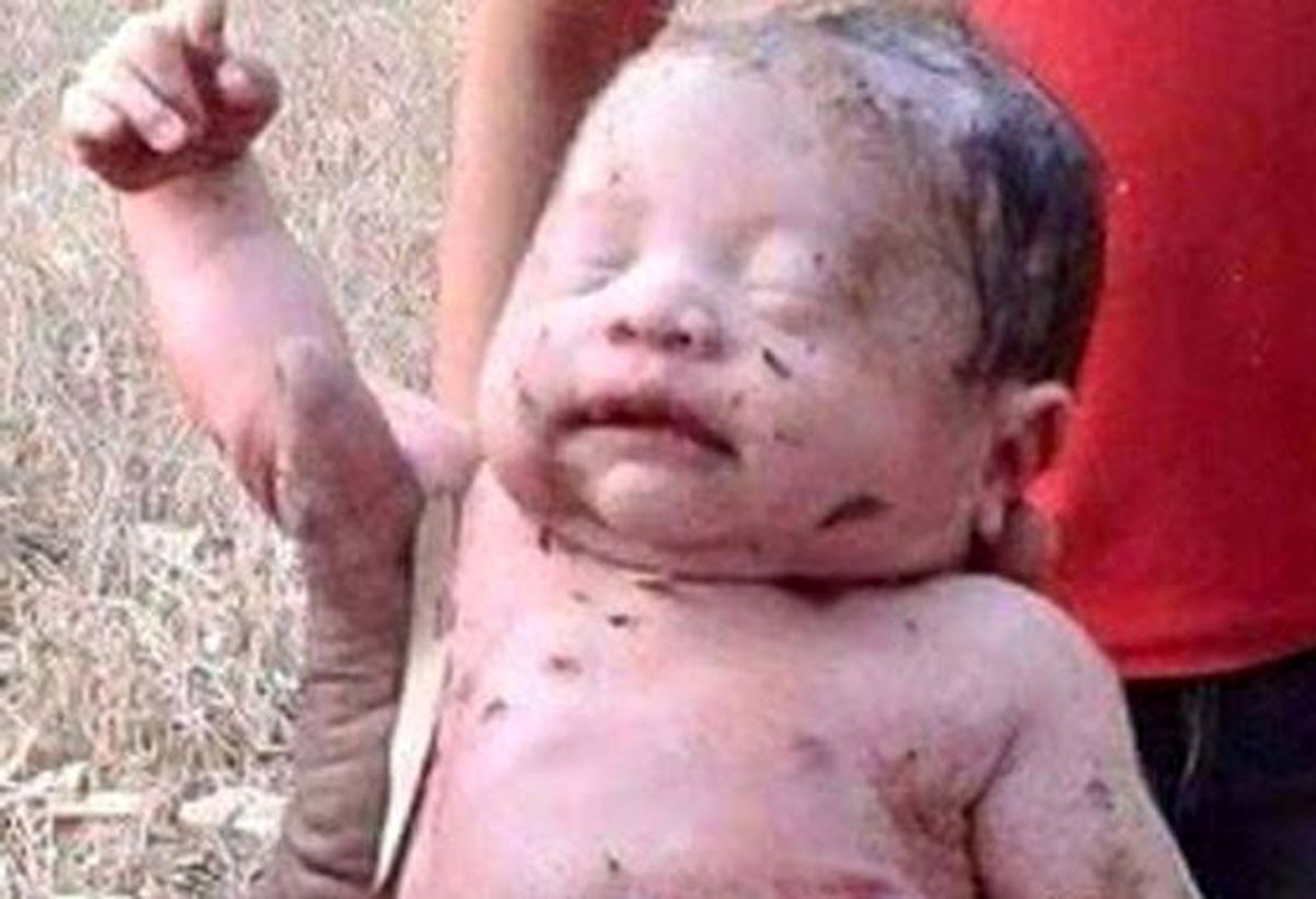 نوزاد هفت ماهه زنده به گور شد اما زنده ماند! +عکس