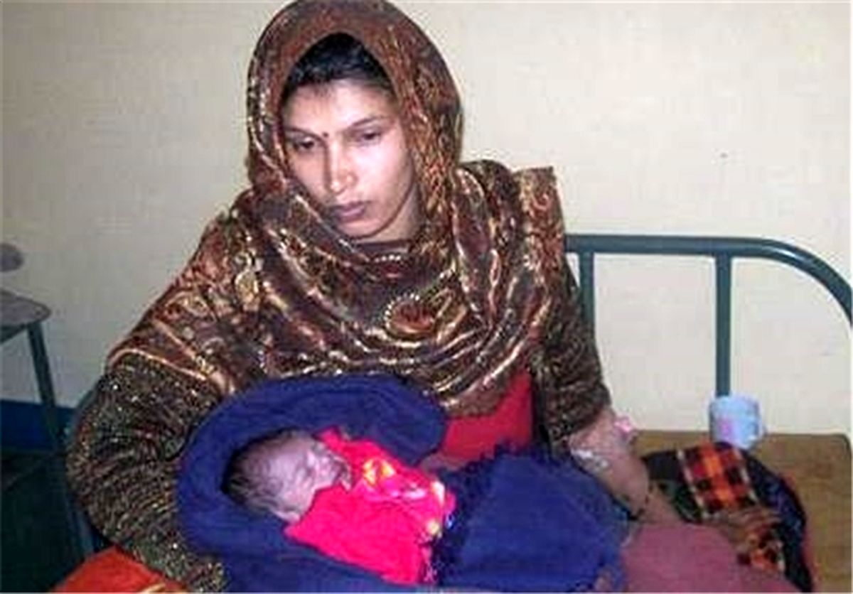 تولد نوزادی با قلبی خارج از بدن/تصاویر